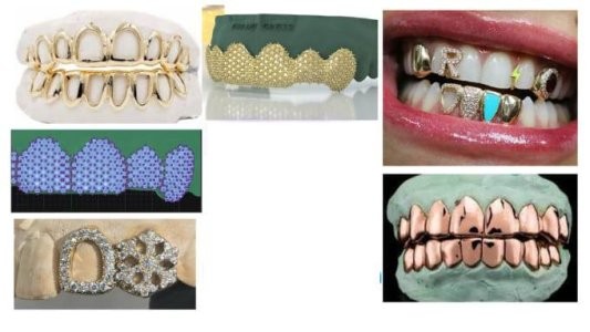 I will 3d design any type of grillz with ice out gem setting and prongs