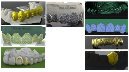 I will 3d design any type of grillz with ice out gem setting and prongs