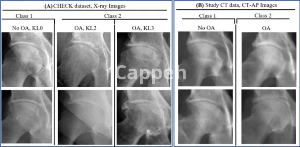 I will do medical image classification and detection in deep learning