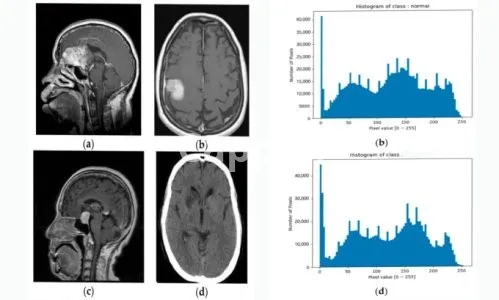 I will do medical image classification and detection in deep learning