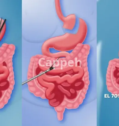 I will create engaging elearning content with motion graphics