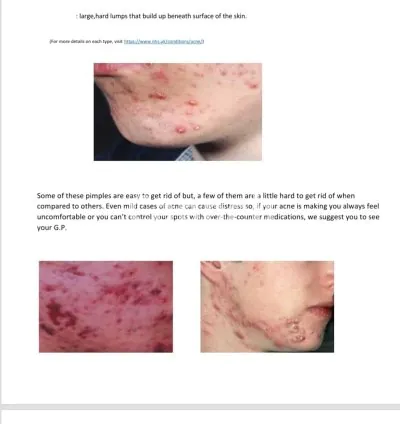 I will be your skincare writer with a medical background