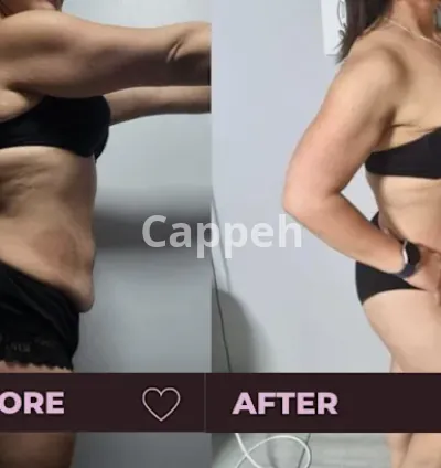 I will help you transform your physique