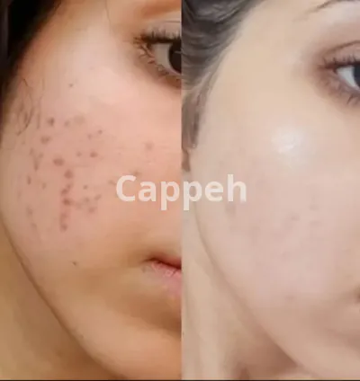 I will create a skincare and haircare routine for you